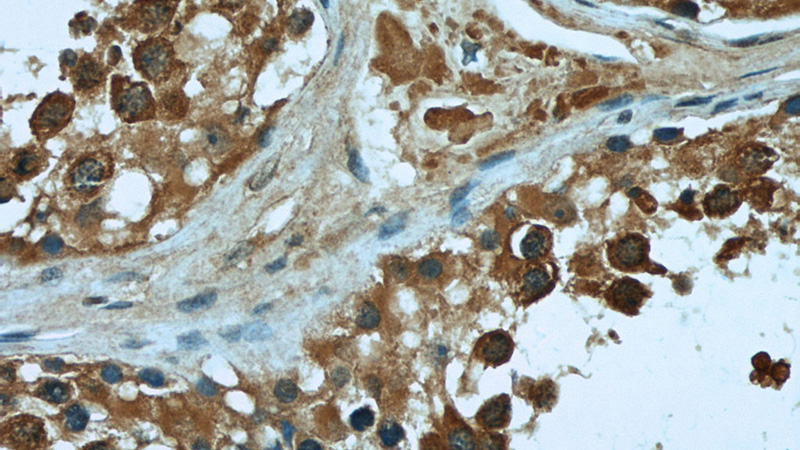 Immunohistochemical of paraffin-embedded human testis using Catalog No:112040(KHSRP antibody) at dilution of 1:50 (under 40x lens)