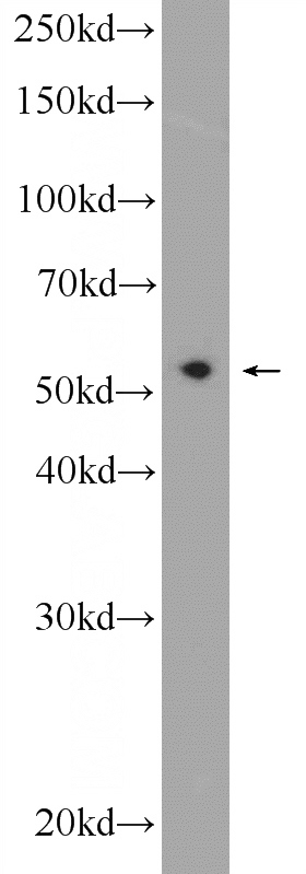 HeLa cells were subjected to SDS PAGE followed by western blot with Catalog No:113651(PDCD7 Antibody) at dilution of 1:600