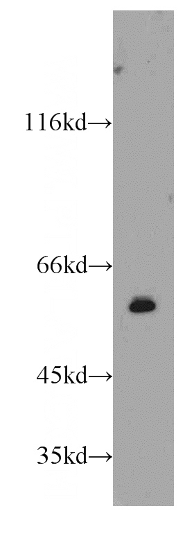 human placenta tissue were subjected to SDS PAGE followed by western blot with Catalog No:116884(YES1-Specific antibody) at dilution of 1:300