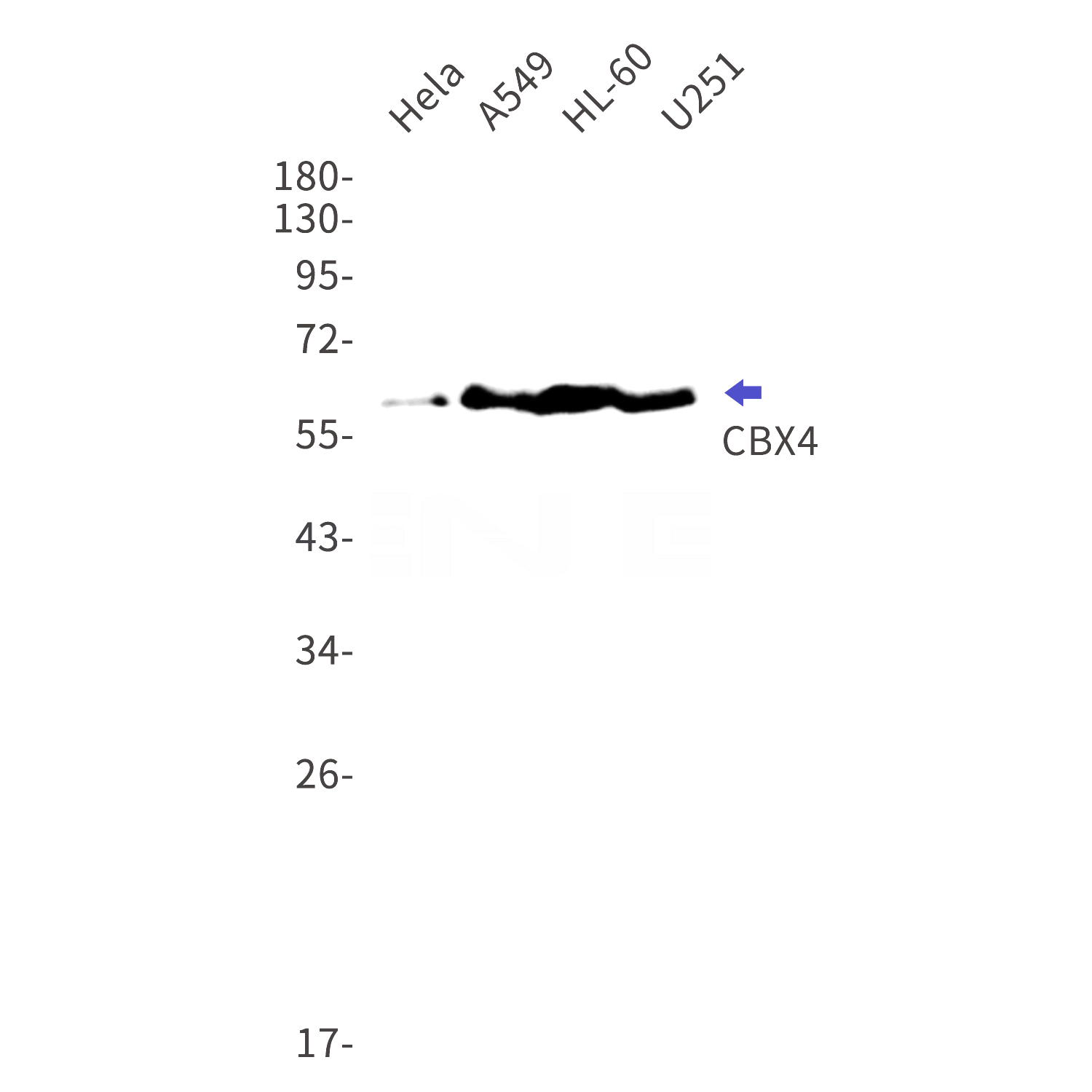 Western blot detection of CBX4 in Hela,A549,HL-60,U251 cell lysates using CBX4 Rabbit mAb(1:1000 diluted).Predicted band size:61kDa.Observed band size:61kDa.
