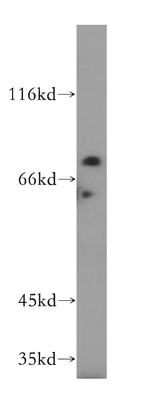 HeLa cells were subjected to SDS PAGE followed by western blot with Catalog No:112344(LSG1 antibody) at dilution of 1:500