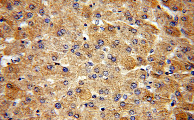 Immunohistochemical of paraffin-embedded human liver using Catalog No:107870(GLA antibody) at dilution of 1:50 (under 40x lens)