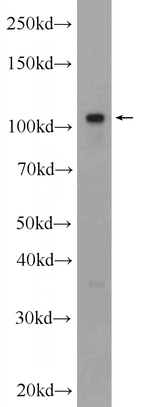 HL-60 cells were subjected to SDS PAGE followed by western blot with Catalog No:111697(IGHMBP2 Antibody) at dilution of 1:600