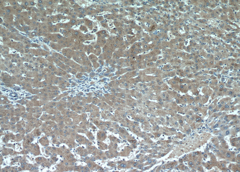 Immunohistochemical of paraffin-embedded human hepatocirrhosis using Catalog No:114537(RANBP10 antibody) at dilution of 1:50 (under 10x lens)