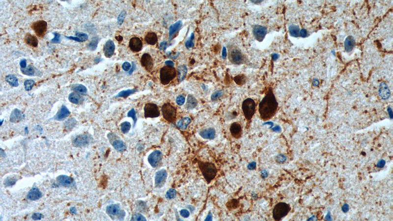 Immunohistochemistry of paraffin-embedded mouse brain tissue slide using Catalog No:116034(TH Antibody) at dilution of 1:200 (under 40x lens).