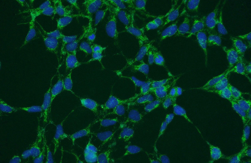 Immunofluorescent analysis of HEK-293 cells using Catalog No:113055(NDFIP1 Antibody) at dilution of 1:50 and Alexa Fluor 488-congugated AffiniPure Goat Anti-Rabbit IgG(H+L)