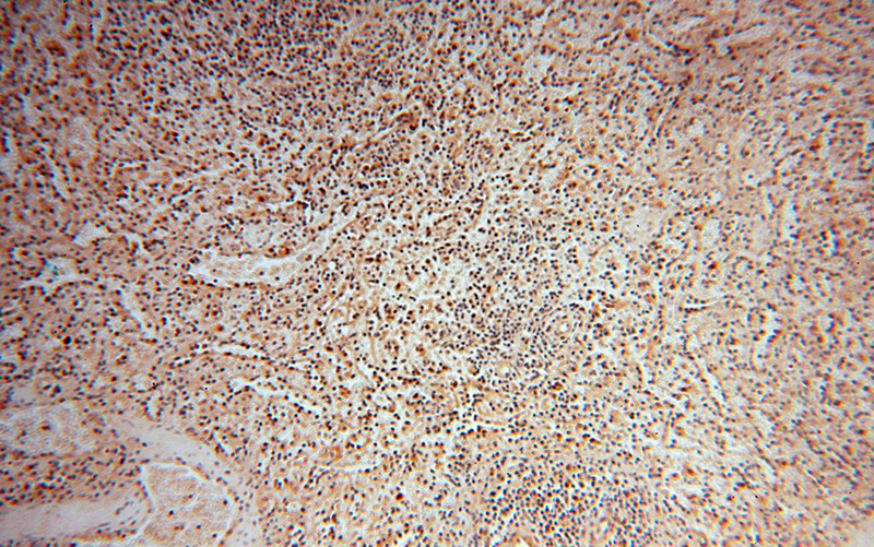 Immunohistochemical of paraffin-embedded human spleen using Catalog No:114033(POLM antibody) at dilution of 1:50 (under 10x lens)