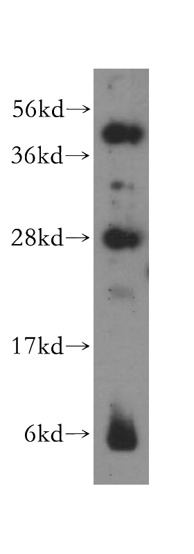 PC-3 cells were subjected to SDS PAGE followed by western blot with Catalog No:114092(PPP1R8 antibody) at dilution of 1:300