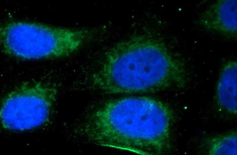 Immunofluorescent analysis of HepG2 cells using Catalog No:112632(MEF2C Antibody) at dilution of 1:50 and Alexa Fluor 488-congugated AffiniPure Goat Anti-Rabbit IgG(H+L)