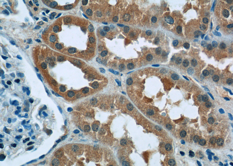 Immunohistochemistry of paraffin-embedded human kidney tissue slide using Catalog No:114803(RPGR Antibody) at dilution of 1:50 (under 40x lens)