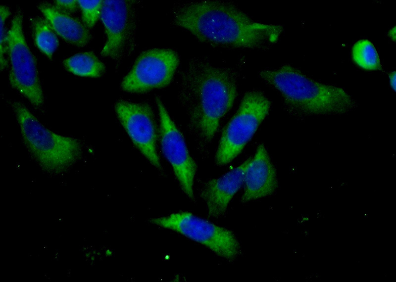 Immunofluorescent analysis of (-20oc Ethanol) fixed HeLa cells using Catalog No:107805(ABCF1 Antibody) at dilution of 1:50 and Alexa Fluor 488-congugated AffiniPure Goat Anti-Rabbit IgG(H+L)