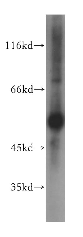 human heart tissue were subjected to SDS PAGE followed by western blot with Catalog No:111146(GPT antibody) at dilution of 1:400