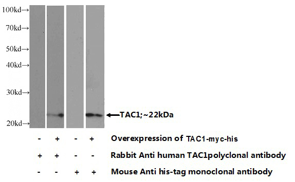 Transfected HEK-293 cells were subjected to SDS PAGE followed by western blot with Catalog No:115966(TAC1 Antibody) at dilution of 1:1000
