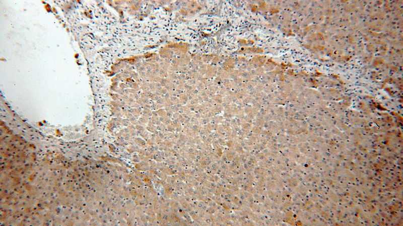 Immunohistochemical of paraffin-embedded human liver using Catalog No:107870(GLA antibody) at dilution of 1:50 (under 10x lens)