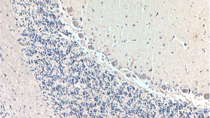 Immunohistochemistry of paraffin-embedded human cerebellum tissue slide using Catalog No:116393(NTRK2 Antibody) at dilution of 1:200 (under 10x lens).