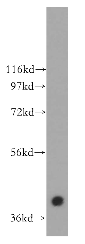HEK-293 cells were subjected to SDS PAGE followed by western blot with Catalog No:108767(CACNG3 antibody) at dilution of 1:500