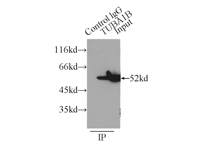 IP Result of anti-Tubulin-Alpha (IP:Catalog No:117297, 3ug; Detection:Catalog No:117297 1:1000) with HeLa cells lysate 5000ug.