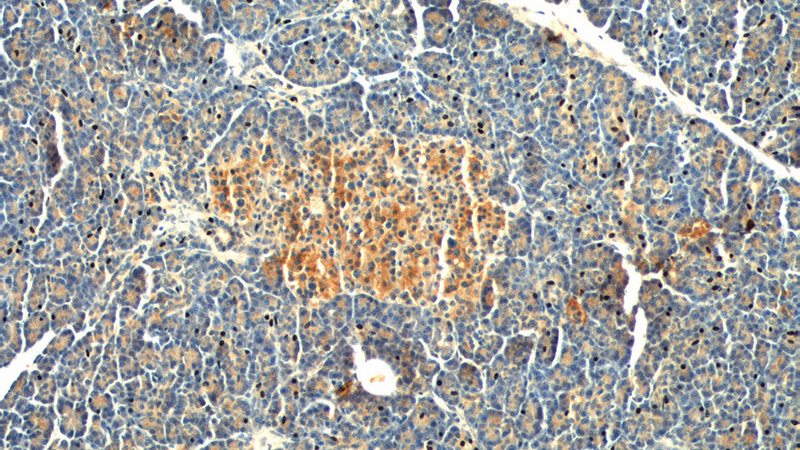 Immunohistochemistry of paraffin-embedded human pancreas tissue slide using Catalog No:111135(GPR81 Antibody) at dilution of 1:50 (under 10x lens)
