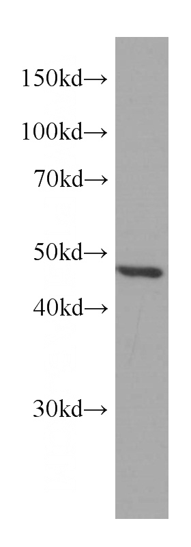 MCF-7 cells were subjected to SDS PAGE followed by western blot with Catalog No:107273(IDH1 Antibody) at dilution of 1:1000