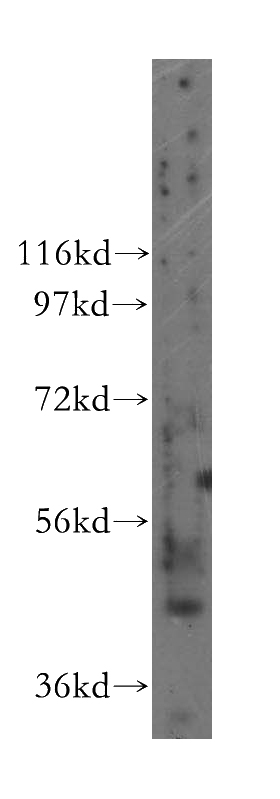human liver tissue were subjected to SDS PAGE followed by western blot with Catalog No:113444(NUPL2 antibody) at dilution of 1:300