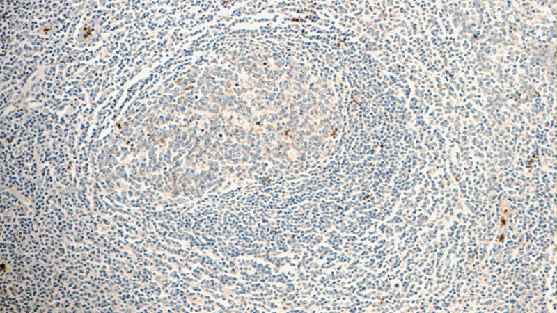 Immunohistochemistry of paraffin-embedded human tonsillitis tissue slide using Catalog No:116162(C3orf23 Antibody) at dilution of 1:50 (under 10x lens)