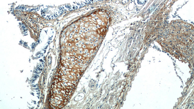 Immunohistochemical of paraffin-embedded human lung using Catalog No:117144(BGN antibody) at dilution of 1:50 (under 10x lens)
