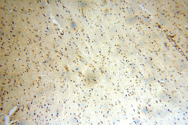 Immunohistochemical of paraffin-embedded human brain using Catalog No:111582(IARS2 antibody) at dilution of 1:100 (under 10x lens)