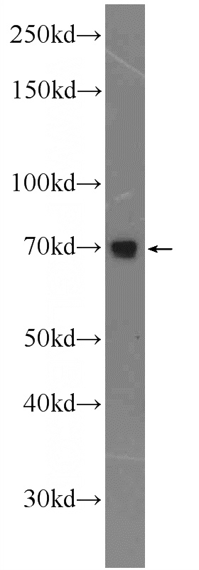 mouse liver tissue were subjected to SDS PAGE followed by western blot with Catalog No:108116(AP1G2 Antibody) at dilution of 1:300