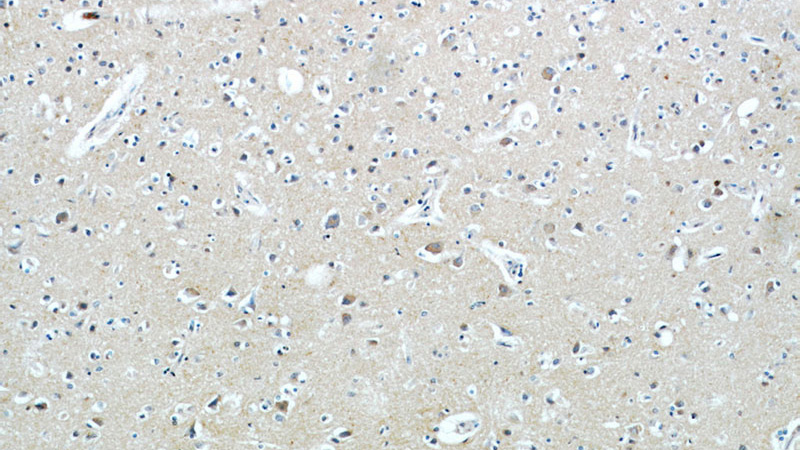 Immunohistochemical of paraffin-embedded human brain using Catalog No:111338(HAPLN4 antibody) at dilution of 1:100 (under 10x lens)