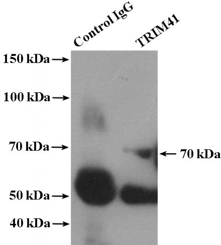 IP Result of anti-TRIM41 (IP:Catalog No:116316, 4ug; Detection:Catalog No:116316 1:600) with human plasma tissue lysate 4000ug.