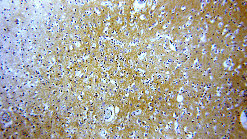 Immunohistochemical of paraffin-embedded human brain using Catalog No:114020(ATP2B2 antibody) at dilution of 1:100 (under 10x lens)