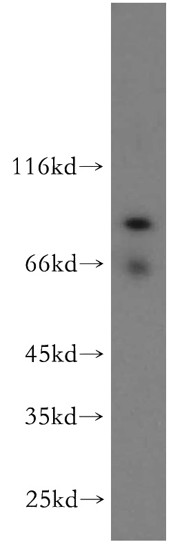 human brain tissue were subjected to SDS PAGE followed by western blot with Catalog No:115024(SCYL3 antibody) at dilution of 1:200