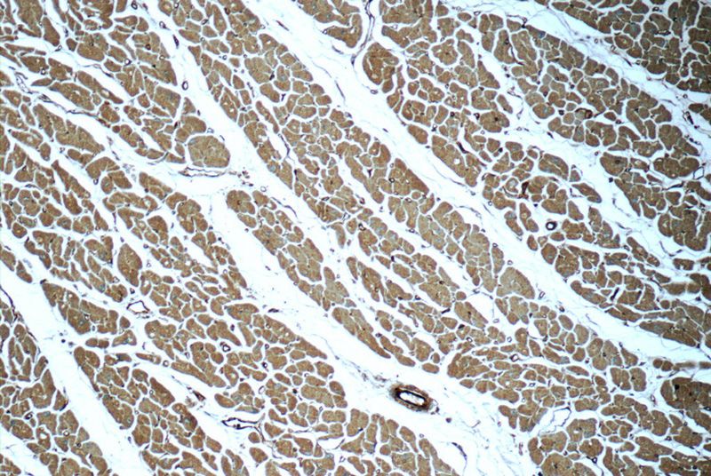Immunohistochemistry of paraffin-embedded human heart tissue slide using Catalog No:112940(MYL12A Antibody) at dilution of 1:50 (under 10x lens)