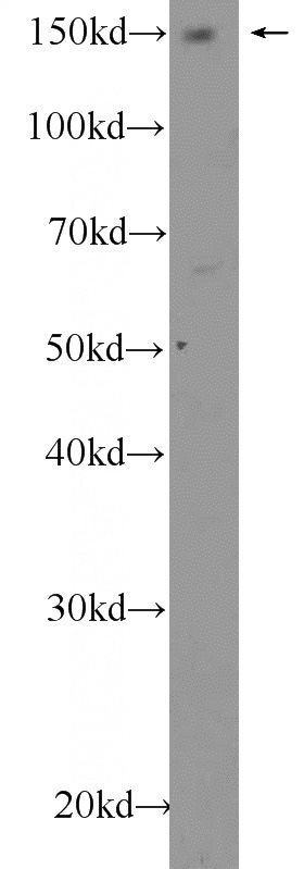 Jurkat cells were subjected to SDS PAGE followed by western blot with Catalog No:107906(AFF4 Antibody) at dilution of 1:600