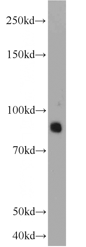 mouse brain tissue were subjected to SDS PAGE followed by western blot with Catalog No:113695(PCDHA5 antibody) at dilution of 1:1000