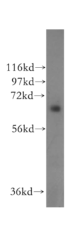 Y79 cells were subjected to SDS PAGE followed by western blot with Catalog No:115109(SENP3 antibody) at dilution of 1:500