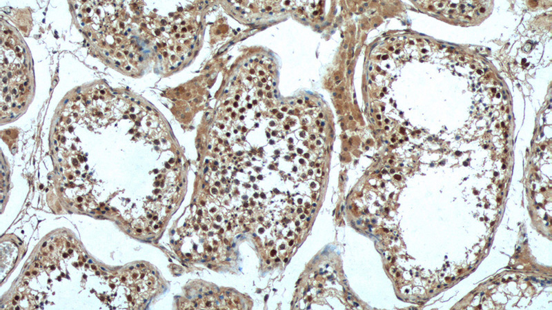 Immunohistochemistry of paraffin-embedded human testis tissue slide using Catalog No:108995(CCHCR1 Antibody) at dilution of 1:50 (under 10x lens)