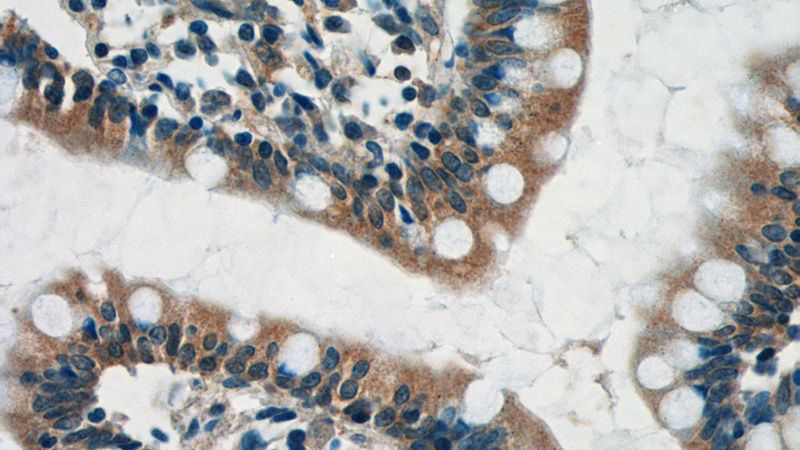 Immunohistochemistry of paraffin-embedded human small intestine tissue slide using Catalog No:109849(DEFA1 Antibody) at dilution of 1:50 (under 40x lens)