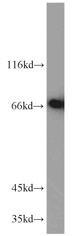 HepG2 cells were subjected to SDS PAGE followed by western blot with Catalog No:112628(MIPEP antibody) at dilution of 1:1000