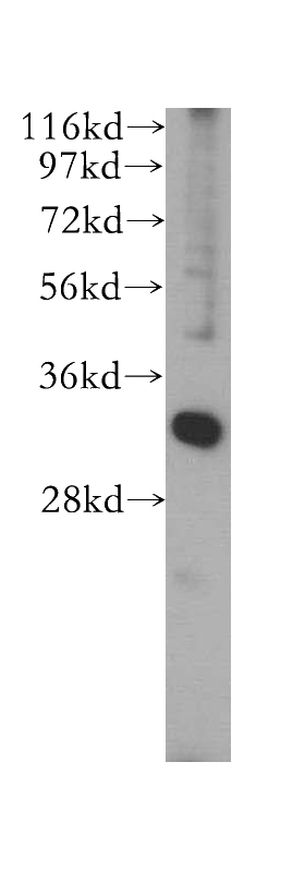 HepG2 cells were subjected to SDS PAGE followed by western blot with Catalog No:115334(SLC25A34 antibody) at dilution of 1:500