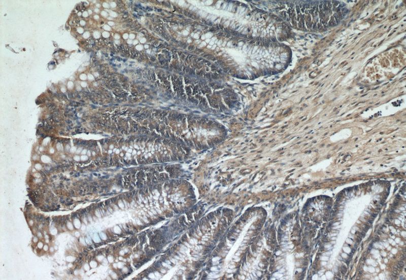 Immunohistochemical of paraffin-embedded human colon using Catalog No:108964(CCDC120 antibody) at dilution of 1:50 (under 10x lens)
