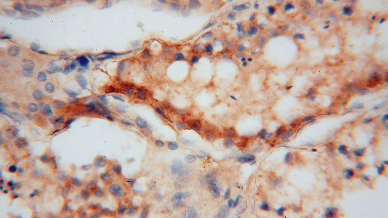 Immunohistochemical of paraffin-embedded human testis using Catalog No:109415(CMIP antibody) at dilution of 1:50 (under 40x lens)