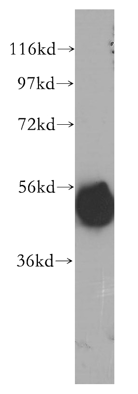 human liver tissue were subjected to SDS PAGE followed by western blot with Catalog No:109533(CPVL antibody) at dilution of 1:500