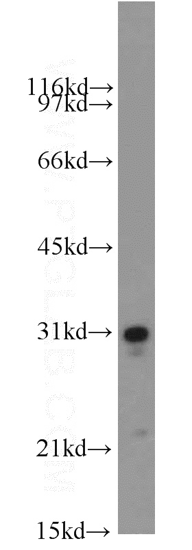 human heart tissue were subjected to SDS PAGE followed by western blot with Catalog No:115494(SOD3 antibody) at dilution of 1:1000