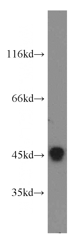 COLO 320 cells were subjected to SDS PAGE followed by western blot with Catalog No:109070(CCNL1 antibody) at dilution of 1:400