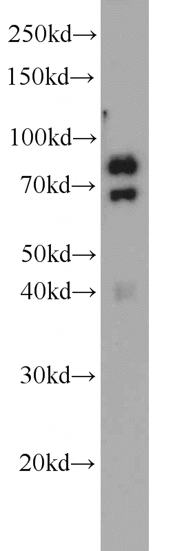 mouse skeletal muscle tissue were subjected to SDS PAGE followed by western blot with Catalog No:113566(PAMR1 antibody) at dilution of 1:500