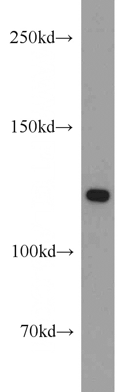 HepG2 cells were subjected to SDS PAGE followed by western blot with Catalog No:114365(PC antibody) at dilution of 1:1000