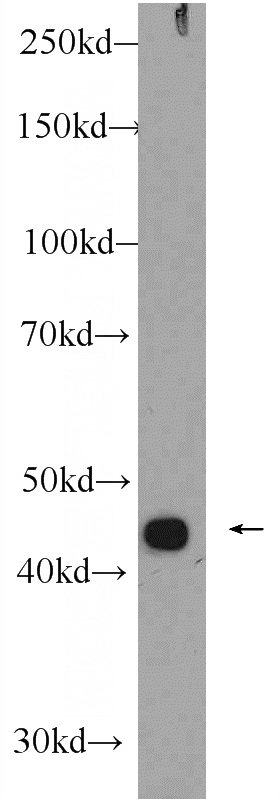 COLO 320 cells were subjected to SDS PAGE followed by western blot with Catalog No:116945(ZNF114 Antibody) at dilution of 1:600