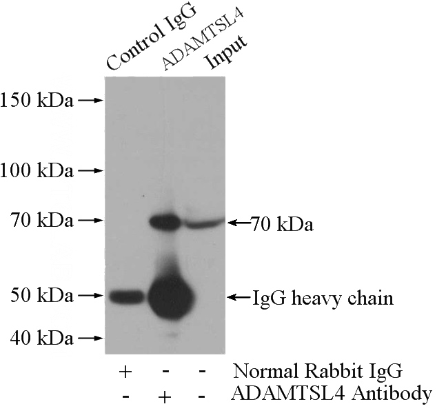 IP Result of anti-ADAMTSL4 (IP:Catalog No:107771, 4ug; Detection:Catalog No:107771 1:500) with mouse brain tissue lysate 3440ug.
