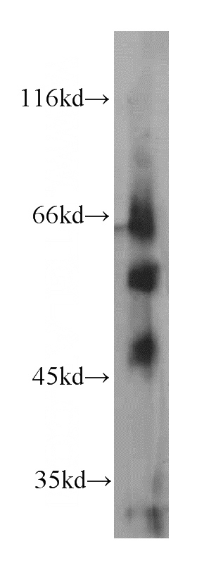 mouse lung tissue were subjected to SDS PAGE followed by western blot with Catalog No:116318(TRIM46 antibody) at dilution of 1:1000